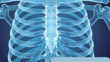 YouTube Thumbnail - Thoracic Needling.png